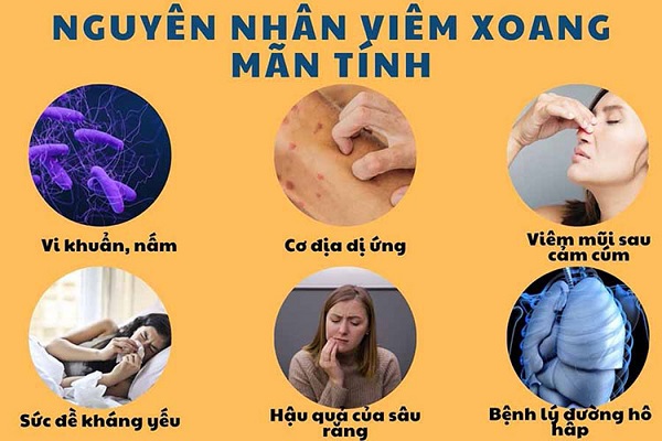 Ảnh minh họa các triệu chứng viêm xoang cấp và mạn tính