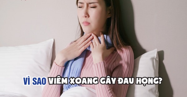 Giải thích cơ chế dịch nhầy từ viêm xoang lan xuống viêm họng