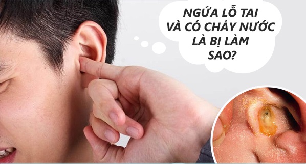 Rủi ro khi tự ý điều trị ngứa tai kéo dài