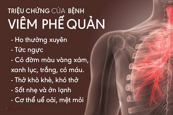 Các triệu chứng điển hình của viêm thanh quản trong hệ thống tai mũi họng