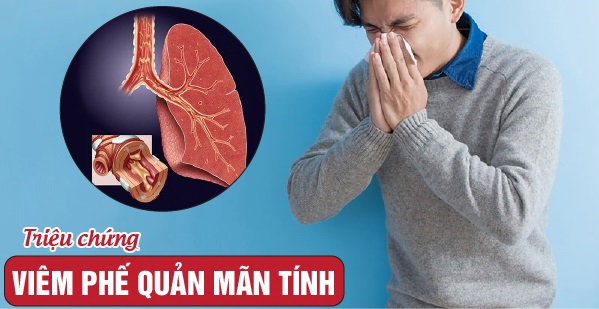 Các sản phẩm thảo dược hỗ trợ điều trị viêm thanh quản của THAPHACO