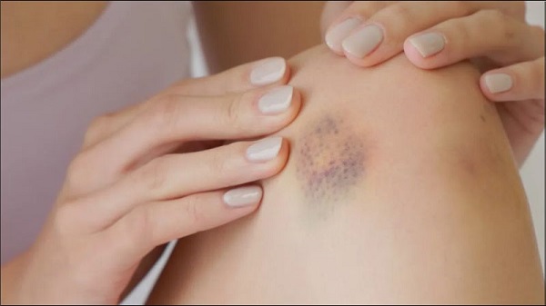 Vitamin K đối với sức khỏe xương, tim và tai mũi họng