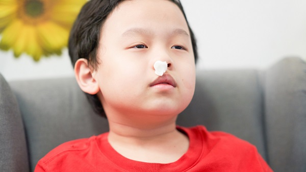 Phòng ngừa và hỗ trợ điều trị chảy máu cam nhờ giải pháp tự nhiên