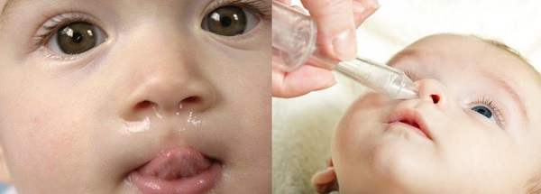 Tình trạng trẻ nhỏ chảy nước mũi phổ biến trong cộng đồng